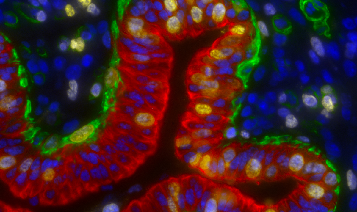 This image that shows developing myoepithelial cells of mammary tissue in a heifer that was created by Mike Akers, head of the Department of Dairy Science.