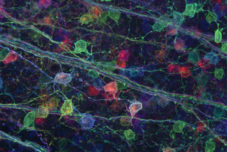 A sample of retinal cells, tagged with several colors. 