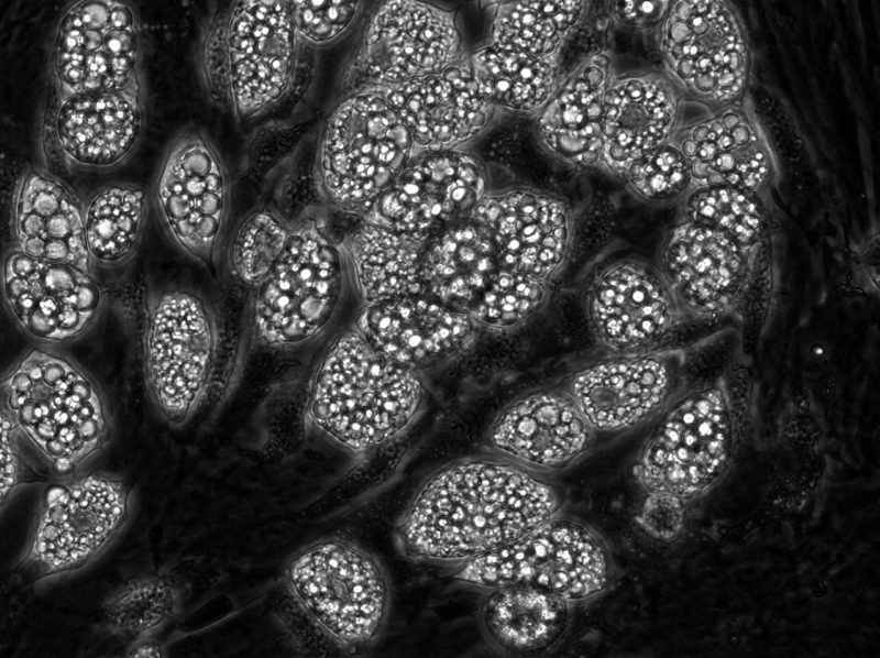Liquid droplets in fat cells