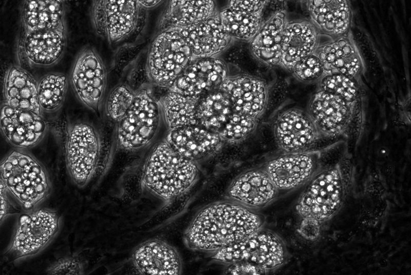 Liquid droplets in fat cells