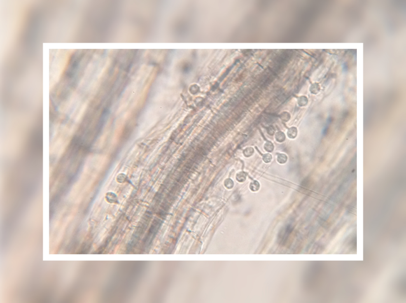 A microscopic image of a large root, which divides the photo into two diagonal sections. On each side of the root, there are many P. capsici spores, which resemble lollipops. 