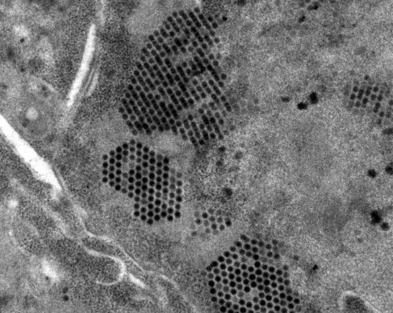 Black and white electron micrograph image of adenovirus producing new virus particles in man-man looking, honey comb-shaped arrays.