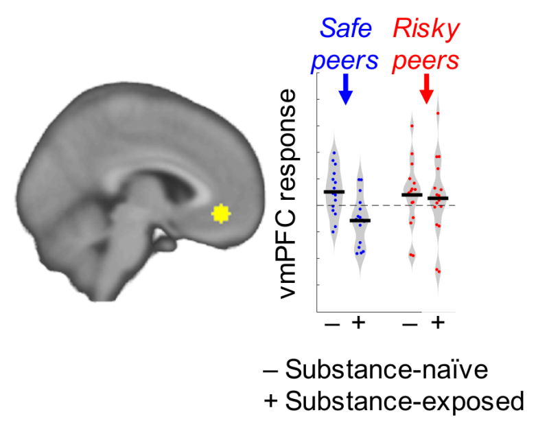 Figure from PNAS Article showing brain scan differences in the two groups of teenagers