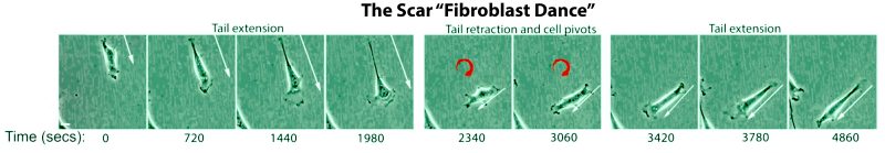 Fibroblast dance