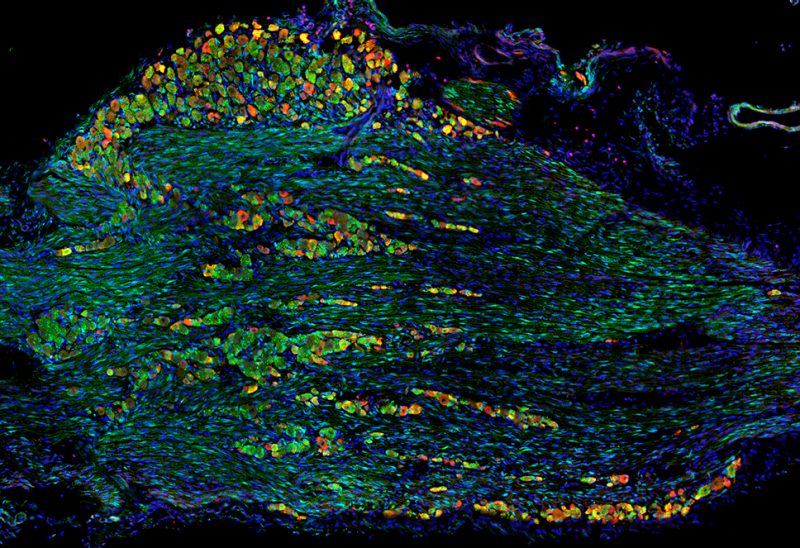 LaMantia Lab Image of Neural Crest, Placode Cells, and Nociceptor Neurons