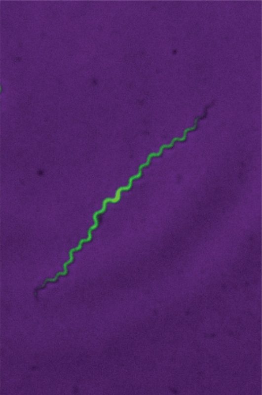  A fluorescent image of Treponema pallidum in a laboratory setting.