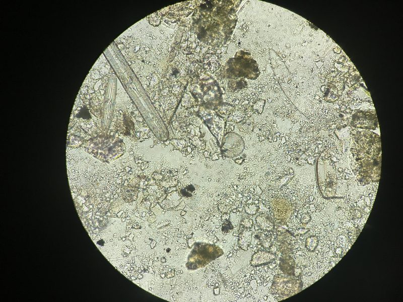 IMG_8545 This shows the magnified image of diatoms through a microscope.