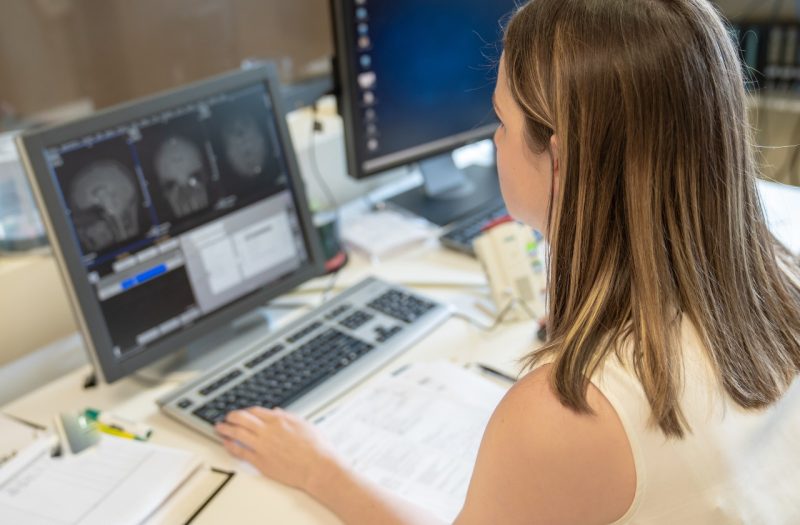 Researcher reviewing brain scans.